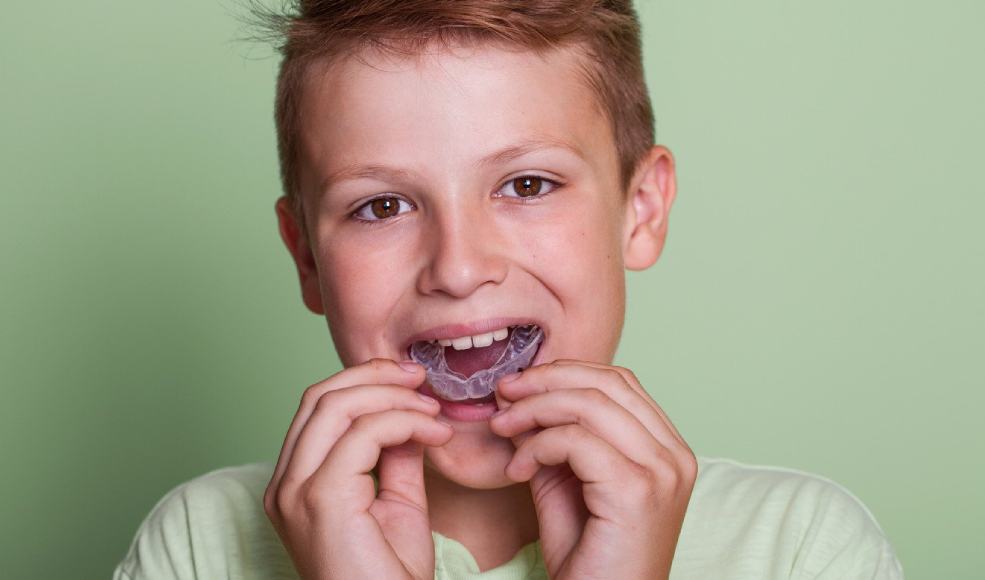 Finding the Perfect Mouthguard for Your Needs