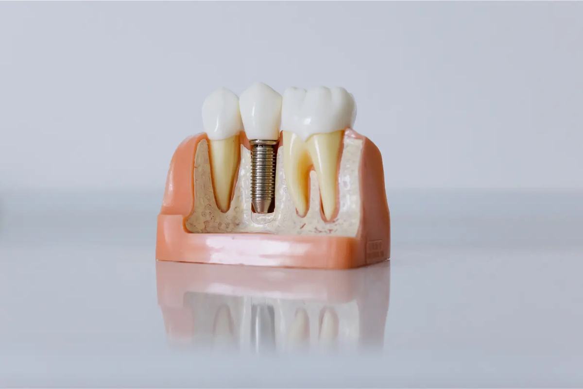 How Bite Adjustments Can Help